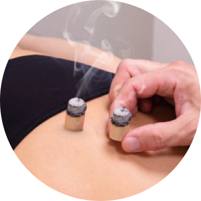 Moxibustion