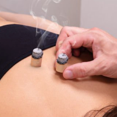 Moxibustion